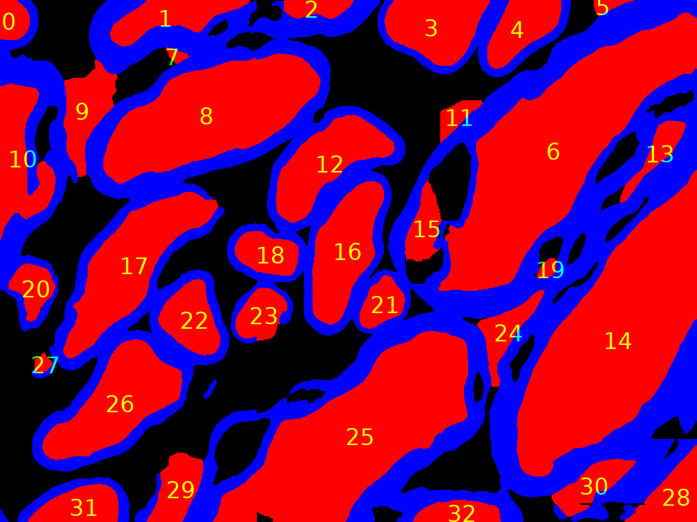 Pathological axon and myelin segmentation