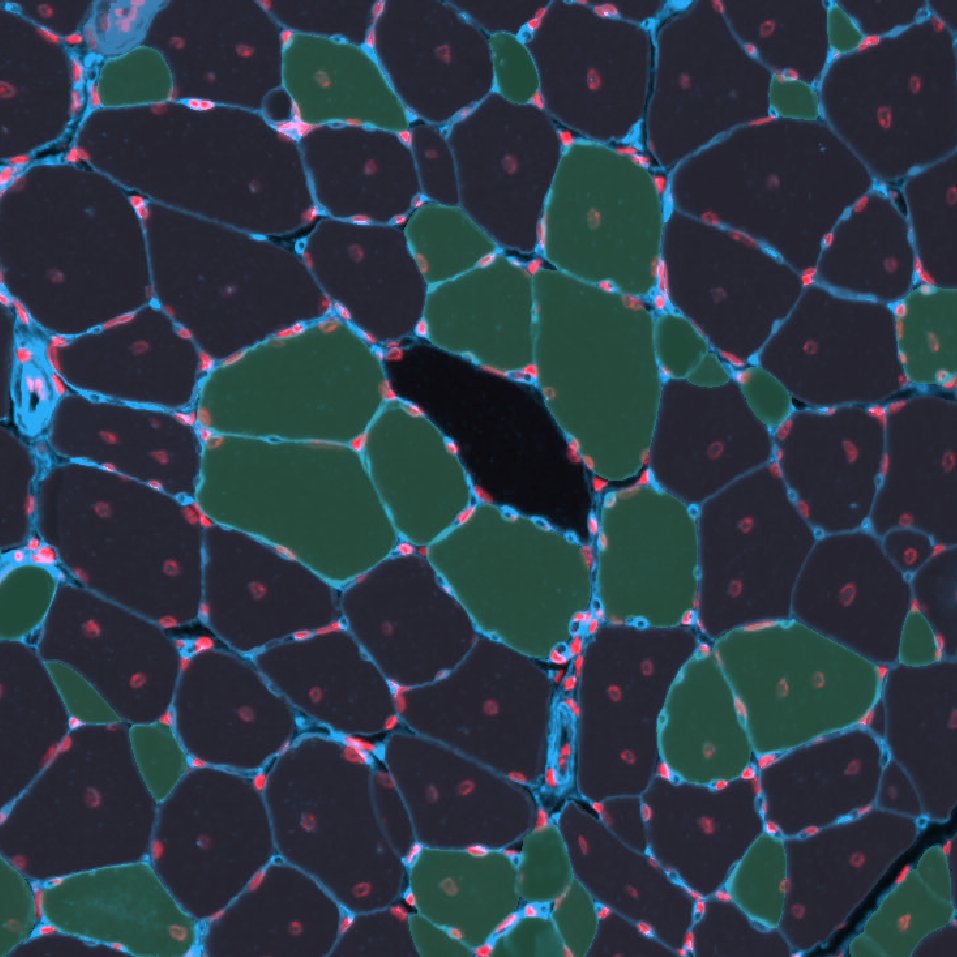 MyoQuant muscle fiber classification