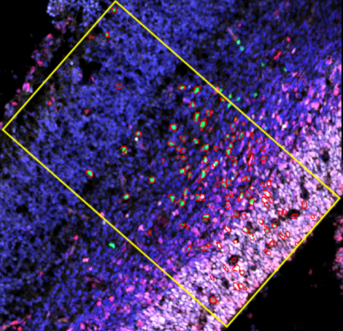 Neuroepithelium electroporated cells analysis