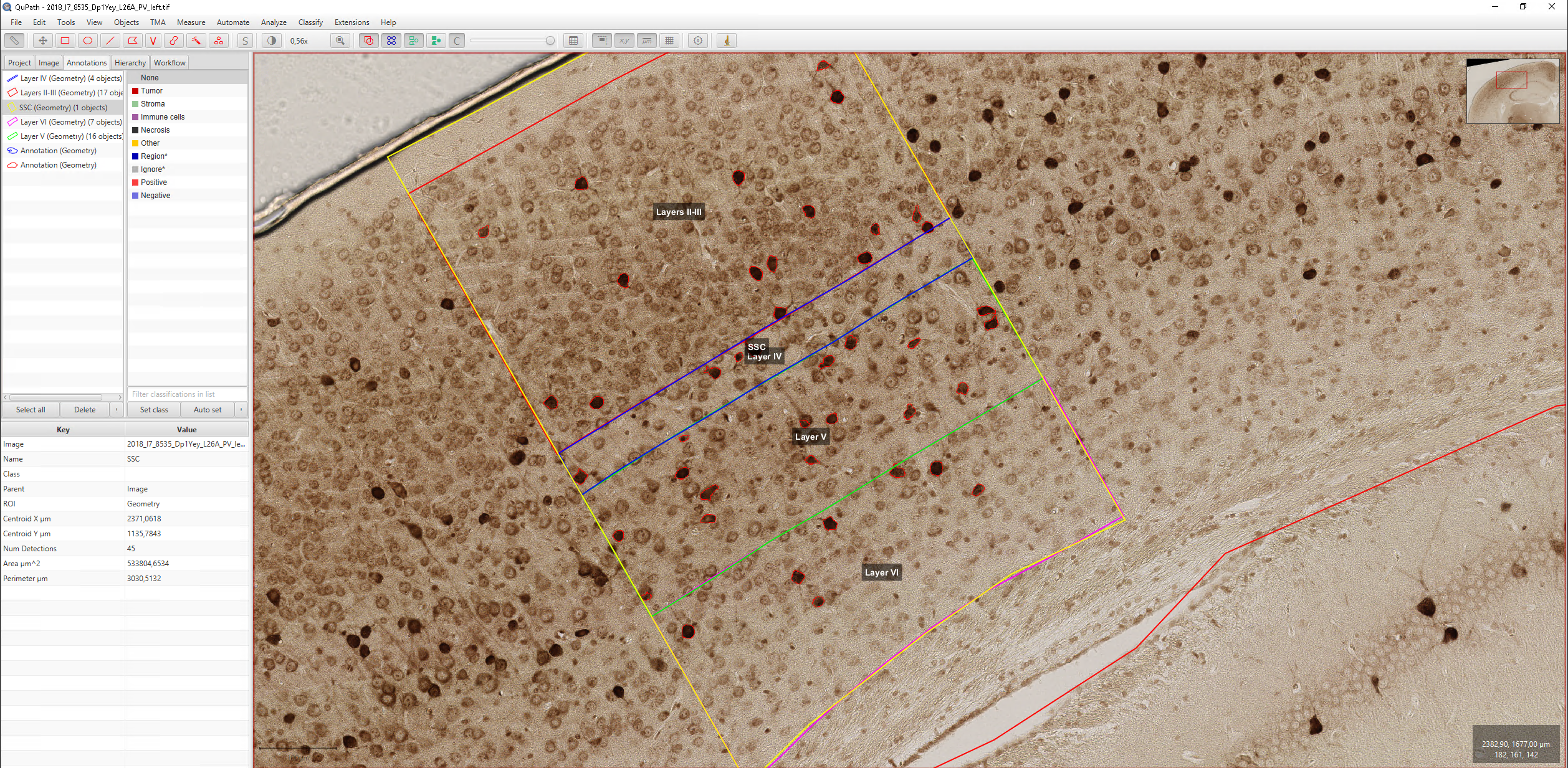 Color deconvolution and neuron detection